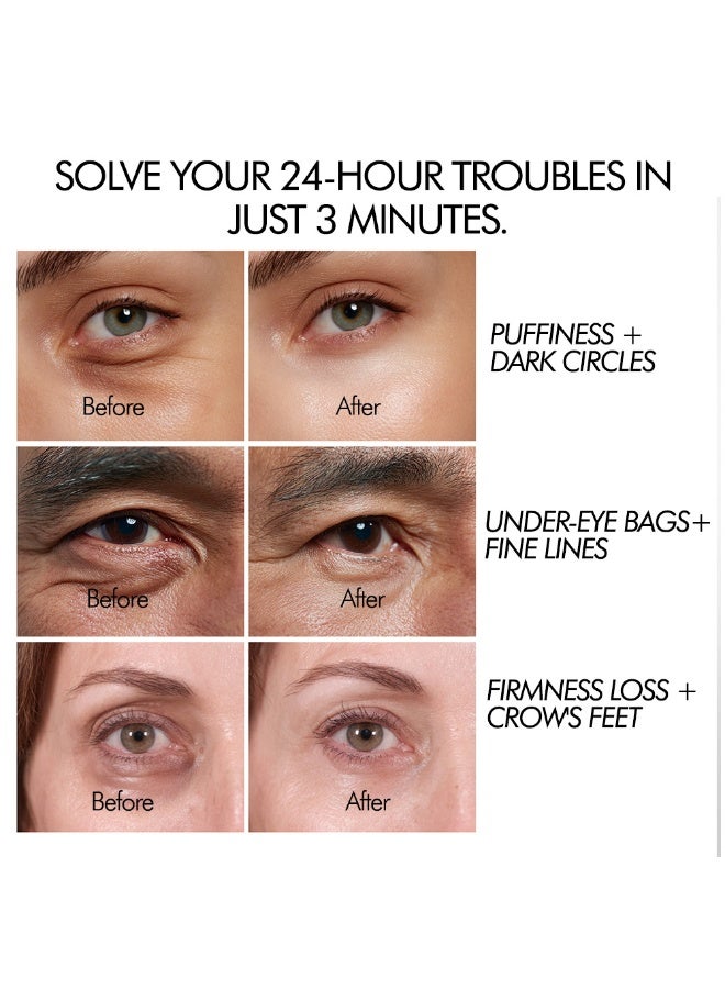 ام اس ال اي ام سيروم إم إس إل إيه إم الفوري لشد منطقة العين: 30 غرامًا لإصلاح دقيق، يشد منطقة العين بسرعة ويقلل من الخطوط الدقيقة والانتفاخ. - Image 5